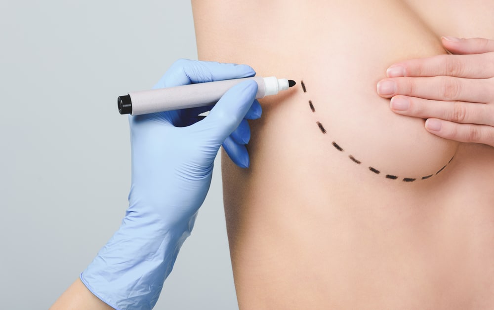Bauchdeckenstraffung: Alles über die postoperative Pflege